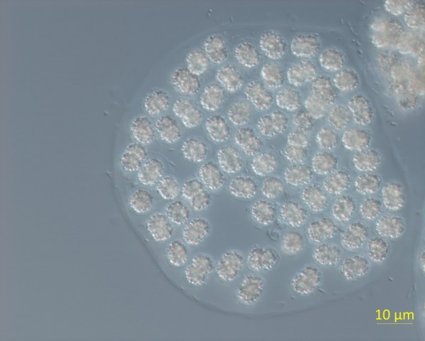 식물플랑크톤(남조류，+Microcystis).jpg