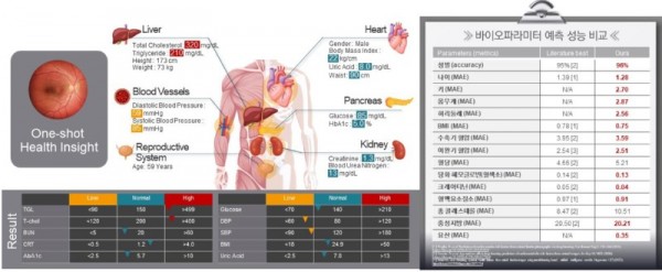 안저영상+기반+바이오+파라메타+예측+모델+및+성능.jpg